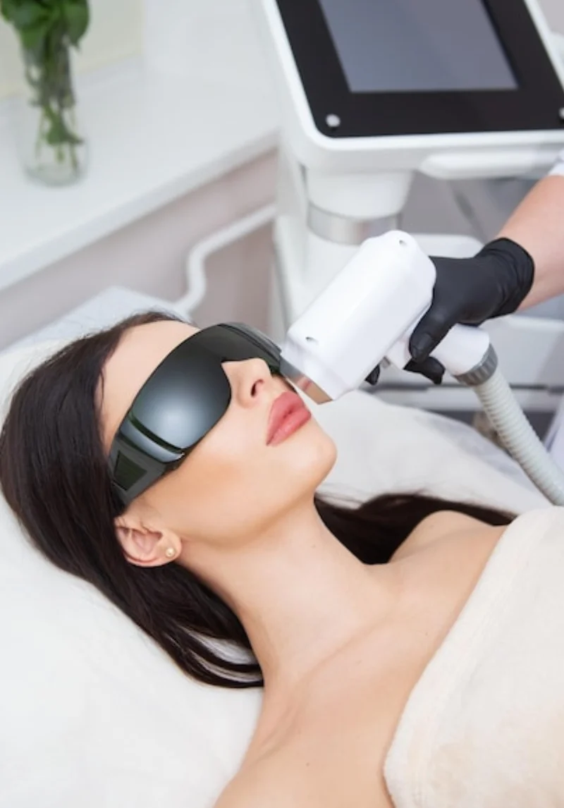 Laser hair removal