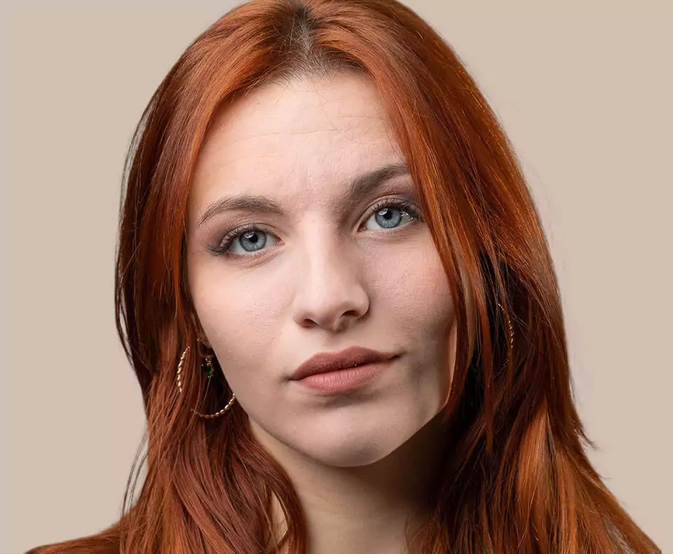 Patient skin after pigmentation treatment