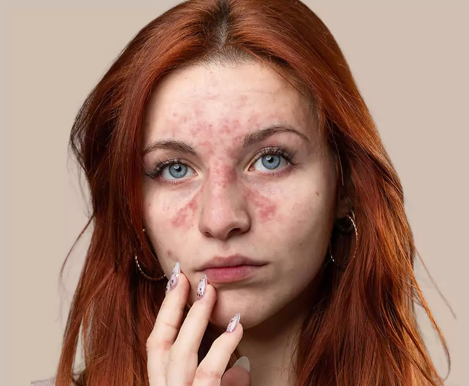 Patient skin before pigmentation treatment